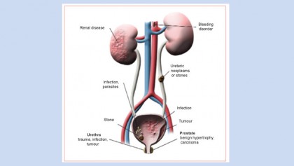 Kidney and urinary tract  
function, disorders and diseases