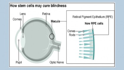 Macular degeneration: 'I've been given my sight back'