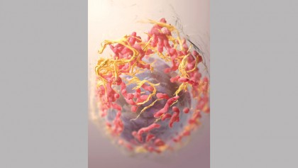 Treatment of Melanoma