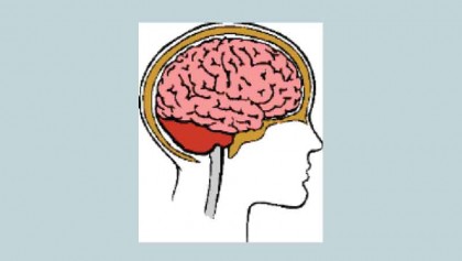 Neurological diseases caused by viruses