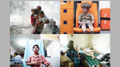 Why Oan Daqneesh’s image did what thousands of others couldn’t