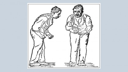 Occupational therapy for parkinson’s disease