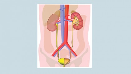 Paediatric kidney and 
urology disorders