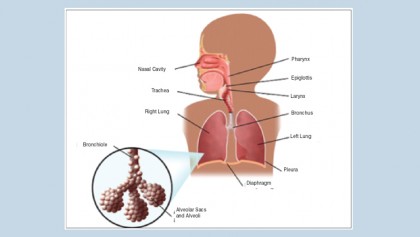 Pneumonia in children