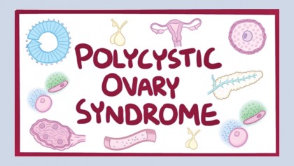 The untold story of Polycystic Ovary Syndrome