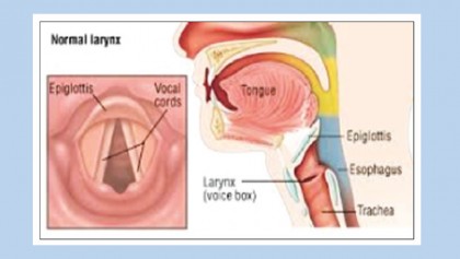 Professional voice disorder & remedy