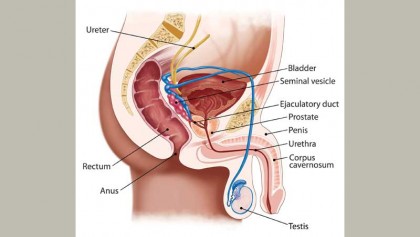 Queries about prostate cancer