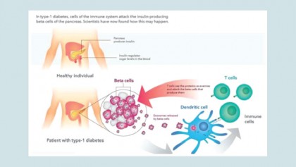 Protein packaging may cause the immune attacks of type 1 diabetes