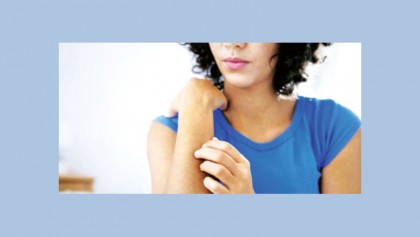 Hives: Red skin rash