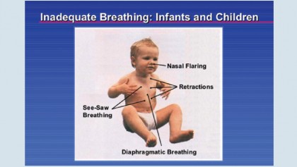 Respiratory emergencies in children