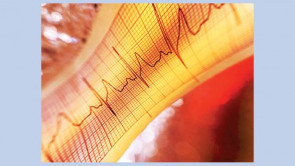 Risk tool can predict heart failure in patients with diabetes