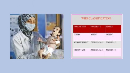 Severe Acute Malnutrition [SAM] among children from mothers’ perspective