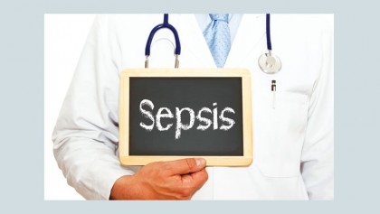 Sepsis: When infection overwhelms