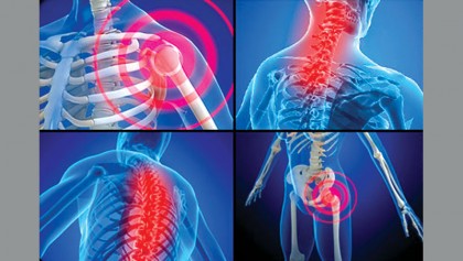 Therapeutic treatments 