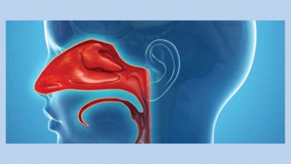 FDA approves Tosymra (sumatriptan) nasal spray for acute treatment of migraine