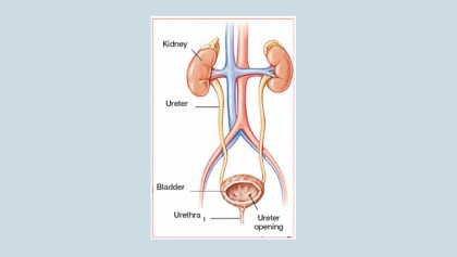 Urinary tract infection