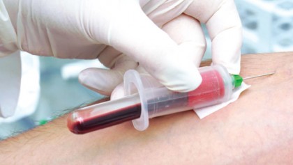 Venepuncture