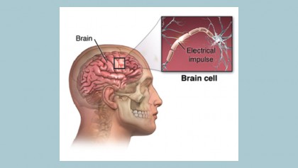 What is a convulsion?