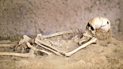 Why our ancestors drilled holes in each other’s skulls? 
