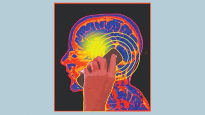 Brain tumours and brain cancer