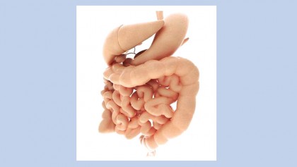 Aspirin can help 
prevent colon cancer, 
but many at risk 