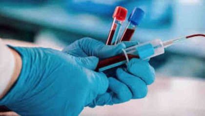 Coronavirus: 440 physicians get infected, says BDF