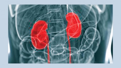 Molecule link to diabetic kidney disease