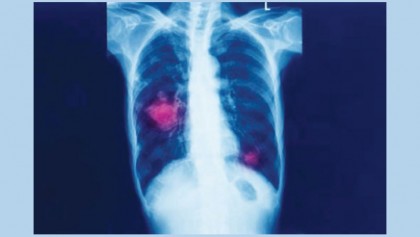 What exactly is a disease?