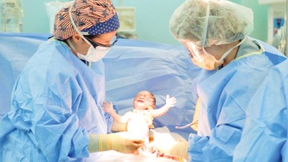 Doctors warn of global C-section ‘epidemic’