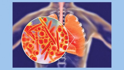 How long is the incubation period for bronchitis?