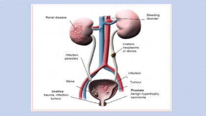 Kidney and urinary tract function, disorders and diseases