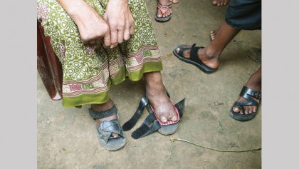 Field level training on leprosy   