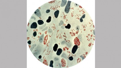 Hospital-based services imperative for leprosy eradication  