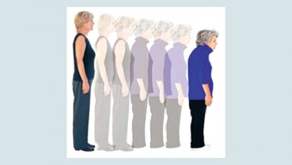 Osteoporosis –prevention and treatment