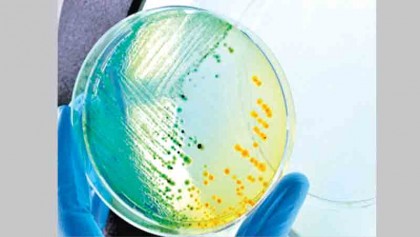 Patients often bring undetected 'superbug' to the hospital: Study