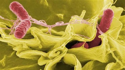 Scientists use bacteria to detect cancer, diabetes