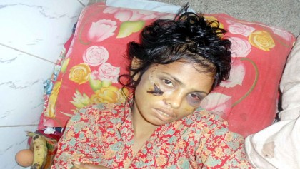 Tortured by husband woman fights for life