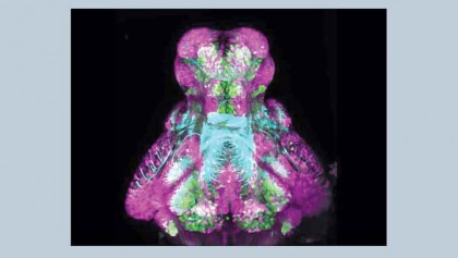 Estrogens alleviate hyperactivity in Zebrafish with Autism gene