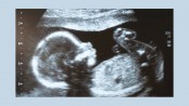 Editing human embryos 'morally permissible'
