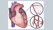 Heart failure : Some vital information