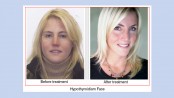 Thyroid fact sheet for women