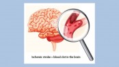 Everything you need to know about stroke