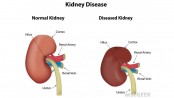 Kidney diseases