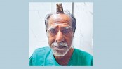 Man grows devil’s horn after injury