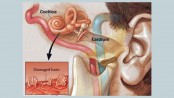 Noise-induced hearing loss