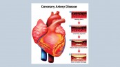 Attempts aiming at prevention of coronary heart diseases