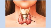 Diverse presentations of hypothyroidism