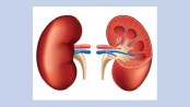 Global facts about kidney disease