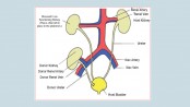 A closer look at kidney transplants