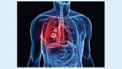 Emerging role of immunotherapy of lung cancer
